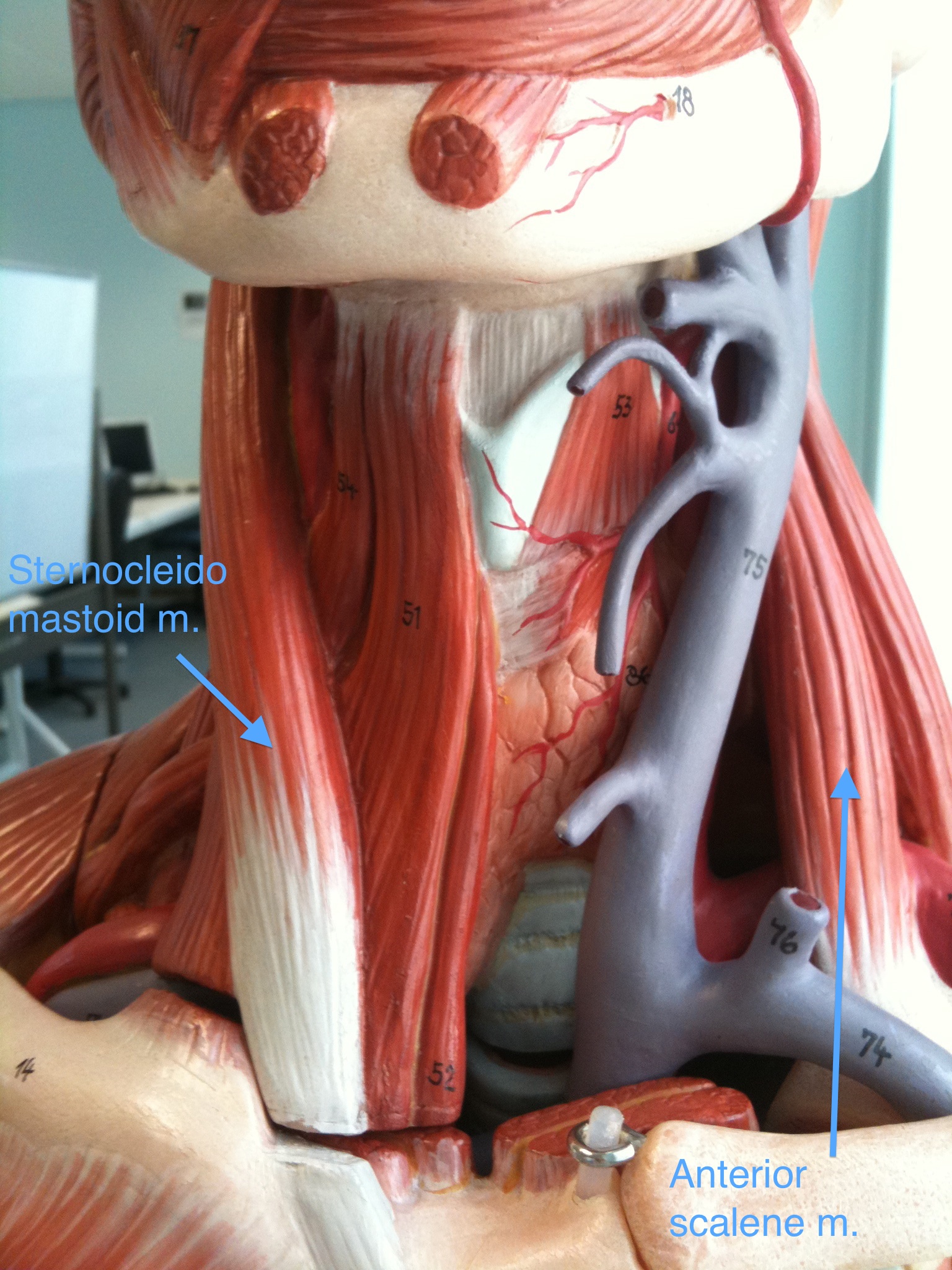 Middle Scalene And Anterior Scalene Cadaver